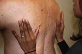 Therapy On Man's Back - Functional Manual Therapy™